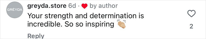 Comment praising strength and determination, describing the inspiring story of 20-year-old amputating leg after rock concert experience.