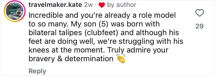 Comment by travelmaker.kate expressing admiration for bravery and determination regarding leg amputation after a rock concert incident.