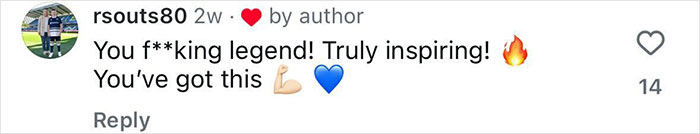 Social media comment praising a 20-year-old who decided to amputate his leg after attending a rock concert, showing support and inspiration.