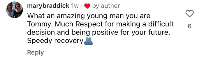 Comment praising a 20-year-old who decided to amputate his leg after a rock concert, respecting his positive outlook and recovery.