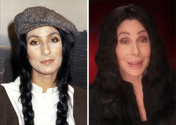 Cher before and after jaw-dropping transformations, showcasing dramatic changes in her appearance over time.
