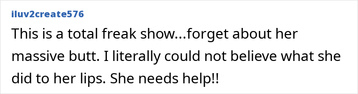 Comment expressing shock about plastic surgery results, mentioning massive butt and altered lips needing help.