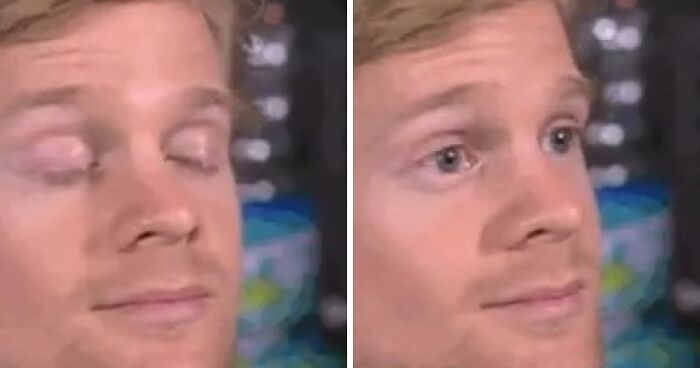 Man Behind “Blinking Guy” GIF Is Unrecognizable 8 Years After Becoming Internet Star