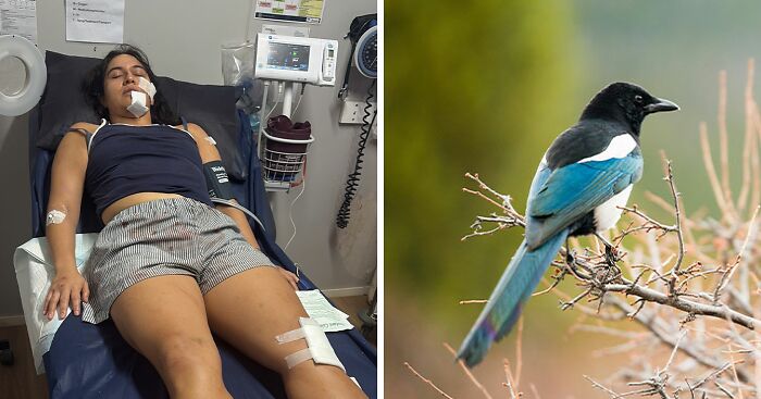 Woman Knocked Unconscious By Bird Reveals Insurance Company Denied Coverage Over 1 Key Detail