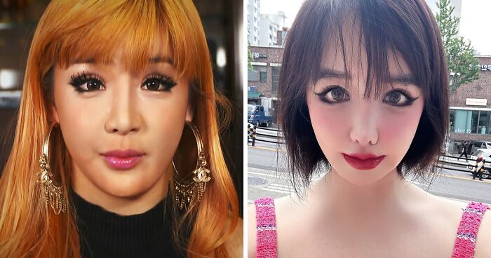 K-Pop Icon Park Bom Reveals Heartbreaking Reason Behind Drastic Plastic Surgery Transformation
