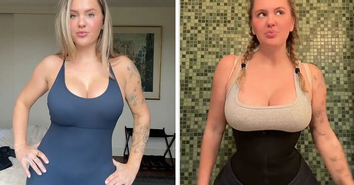 Mom Who Got Her Ribs Broken To Make Waist ‘Smaller’ Reveals Transformation In Before-And-After Clips