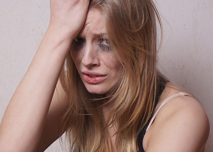 Distressed woman with smudged makeup holding her forehead, representing a villain in someone else’s story concept.