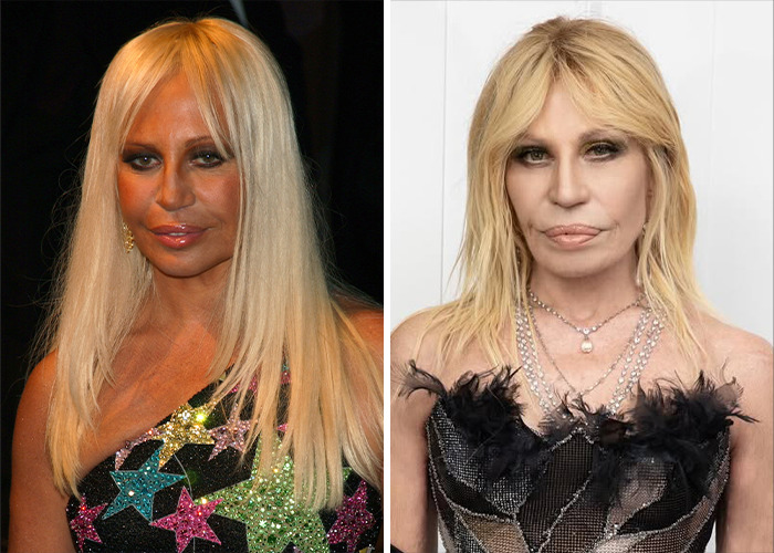 Side-by-side photos showing dramatic celebrity transformations highlighting stars who barely look like themselves after changes.