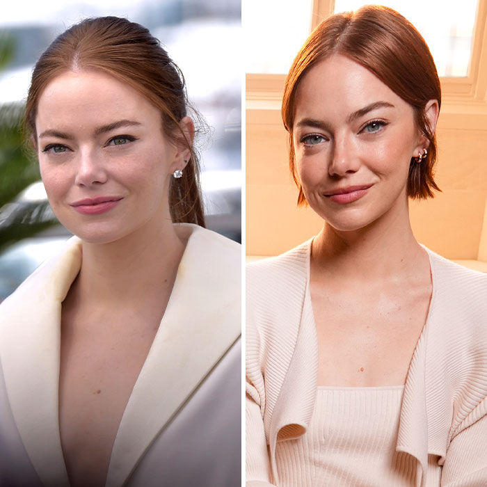 Emma Stone in two photos wearing light-colored outfits, sparking plastic surgery speculation amid Louis Vuitton events.