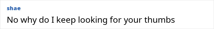 Text message saying No why do I keep looking for your thumbs, illustrating this thumbless man's quirky humor and genius life hacks. Text message saying No why do I keep looking for your thumbs, illustrating this thumbless man's quirky humor and genius life hacks.