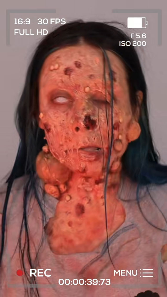 Close-up of a person with detailed Halloween makeup featuring realistic infection and tumor effects on the face and neck.