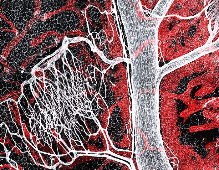 Microscopic image showing intricate white and red vascular structures captured in the 2025 Nikon Small World contest.