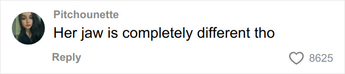 Social media comment reacting to Jennifer Lawrence plastic surgery plans, mentioning her jaw looks different with 8,625 likes.
