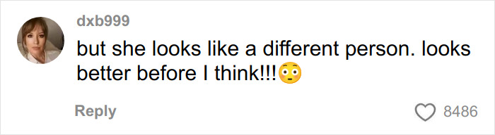 Comment discussing Jennifer Lawrence plastic surgery plans after viral video, with a surprised emoji and user reactions.