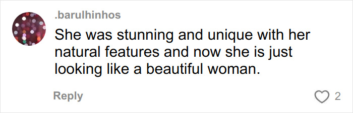 Comment discussing Jennifer Lawrence's natural look and reactions to plastic surgery plans after viral video shock.