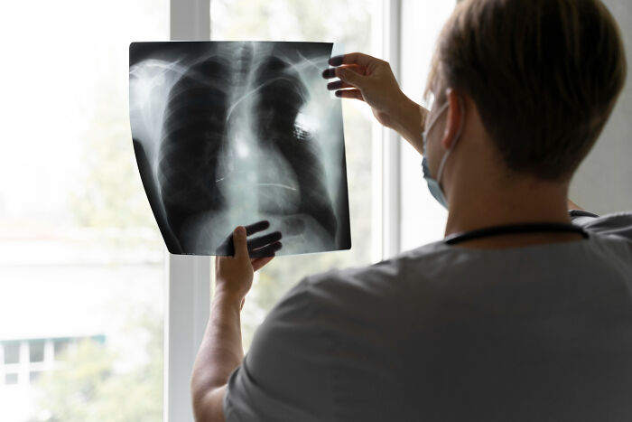Medical professional examining chest x-ray to identify underlying health issue beyond anxiety symptoms.
