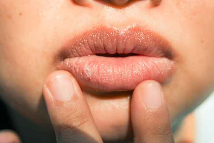Close-up of dry, chapped lips being touched by fingers, illustrating random things people did as kids.