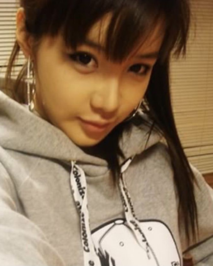 K-Pop icon Park Bom wearing a gray hoodie, showcasing her look amid her plastic surgery transformation.