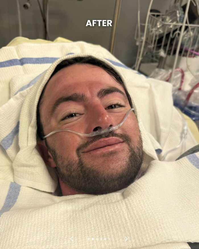 Man Who Swam For 110 Miles Without Sleeping Reveals "Intense" Hallucinatory Experience