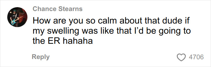 TikToker&rsquo;s hair transplant recovery comment showing swelling and humor with 4706 likes on social media post.