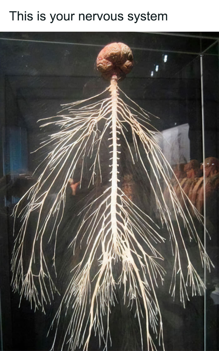 Human nervous system display with brain and nerve network, a fascinating and deeply unsettling medical post exhibit.