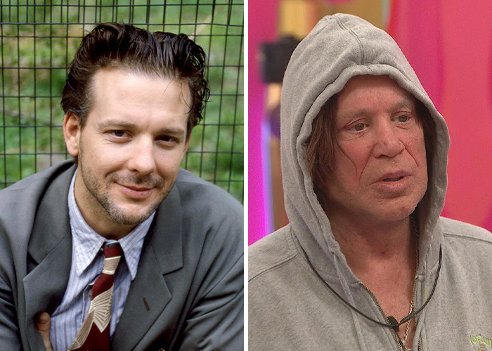 Side-by-side photos showing a star before and after jaw-dropping transformations revealing drastic changes in appearance.