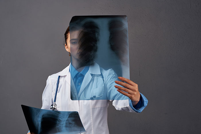 Doctor in white coat examining chest X-rays representing people self-diagnosing and medical correction scenarios.