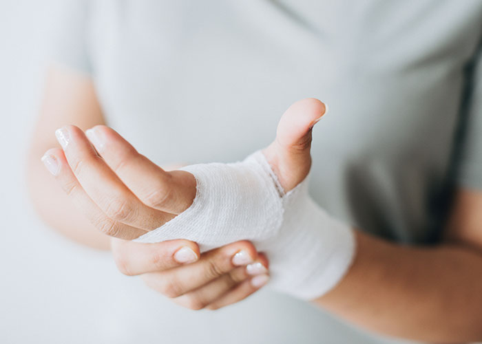 Injured hand with white bandage being held, symbolizing conflict involving HOA board member and pet ownership rules.