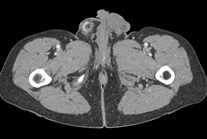 “Patients Are Not Widgets”: Expert Weighs In On People Turning To ChatGPT After Doctors Miss The Mark “Patients Are Not Widgets”: Expert Weighs In On People Turning To ChatGPT After Doctors Miss The Mark