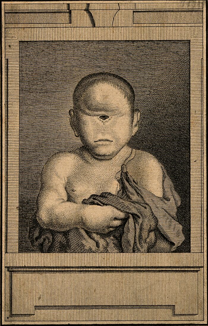 Engraving of a cyclops baby with one eye, representing disturbing Wikipedia pages that reveal dark rabbit holes online.