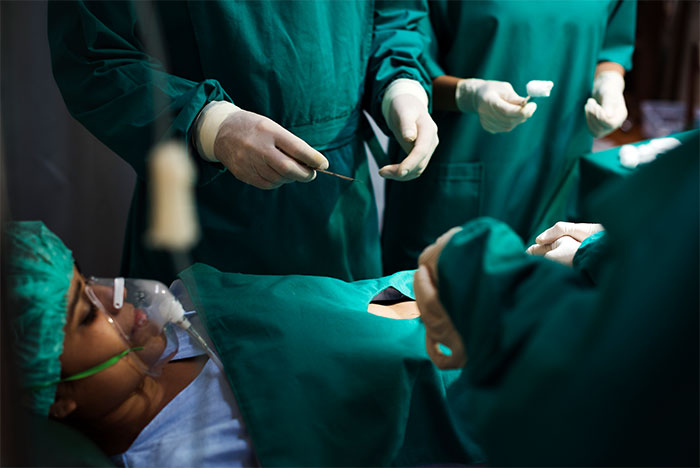 Surgical team in green scrubs performing an operation while patient lies unconscious under anesthesia in operating room.