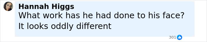 Comment from Hannah Higgs questioning what facial work Bradley Cooper might have had, noting his face looks oddly different. Comment from Hannah Higgs questioning what facial work Bradley Cooper might have had, noting his face looks oddly different.