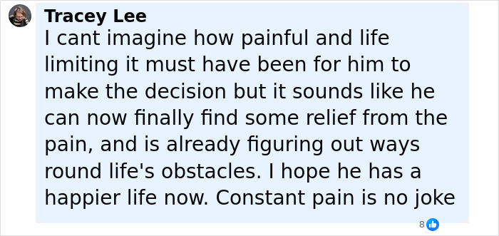 Comment by Tracey Lee about a 20-year-old's decision to amputate his leg for relief from constant pain after a rock concert.