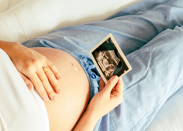 Pregnant woman holding a sonogram image, highlighting a funny detail on the ultrasound photo while resting on a bed.