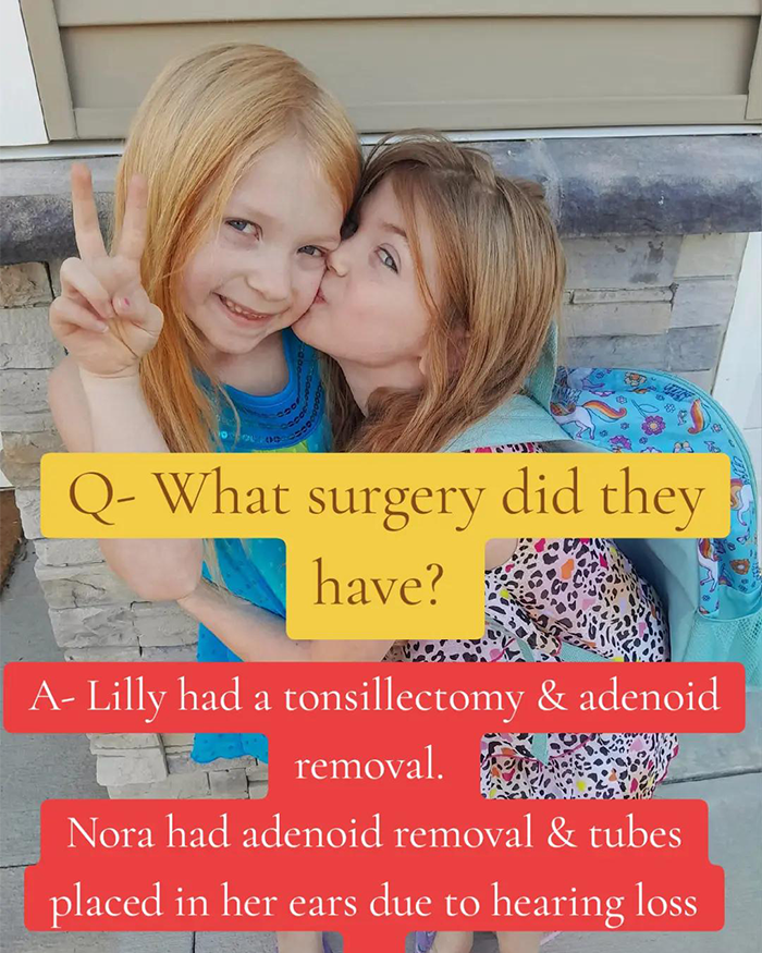 Two little sisters smiling after surgery, highlighting a heartmelting hospital gesture capturing netizens' emotional response.