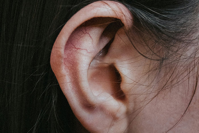 Close-up of a person’s ear showing redness and visible blood vessels, representing unexpected surgery cases in hospitals.
