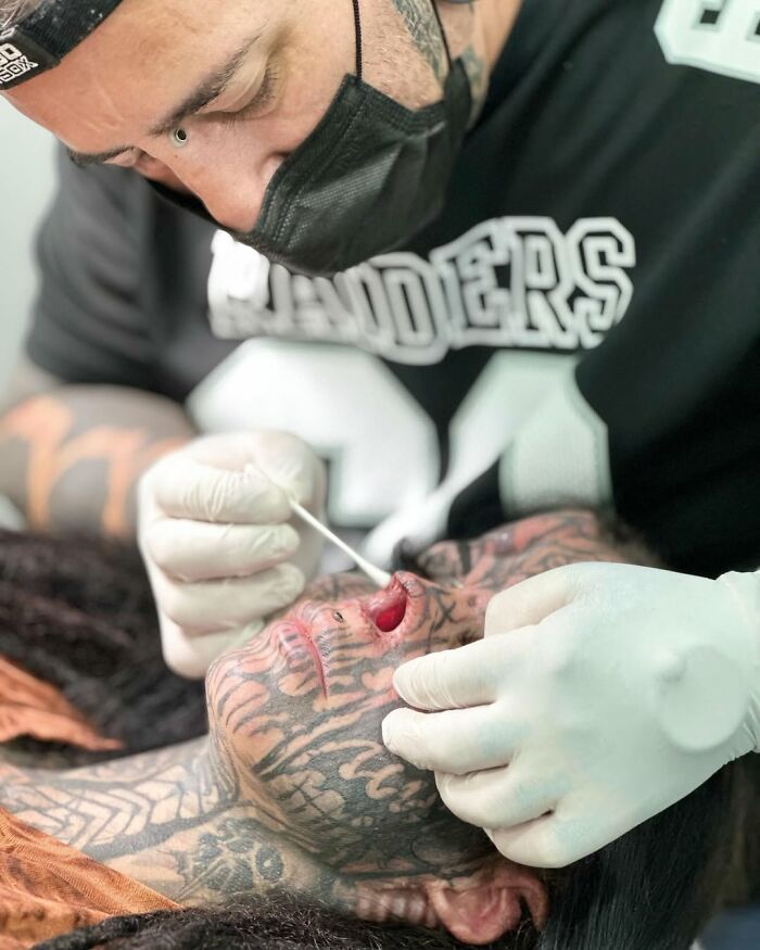 Tattooed woman with nose cut off receiving care in viral before-and-after photos showing preserved nose in a jar.