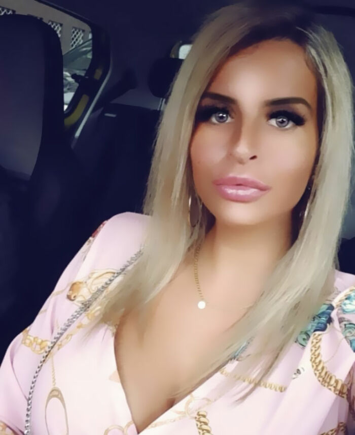 Tattooed woman with blonde hair and makeup sitting in a car, related to before-and-after photos of nose removal.