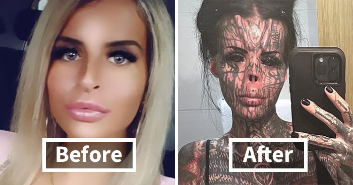 Woman Who Cut Her Nose Off Shares Shocking Before-And-After Pics