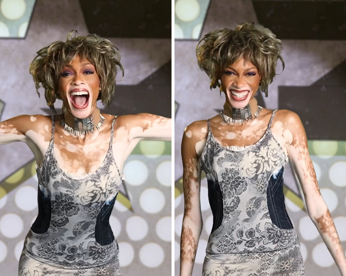Winnie Harlow wearing a patterned dress and choker while facing backlash for channeling Whitney Houston for Halloween.