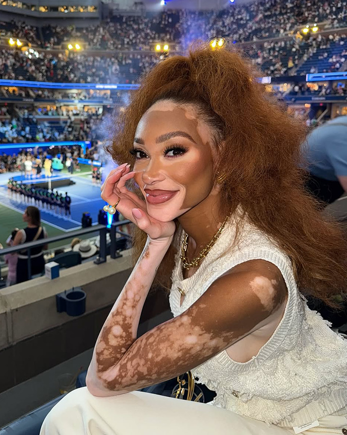 Winnie Harlow posing at a crowded event, facing backlash after channeling Whitney Houston for Halloween costume.
