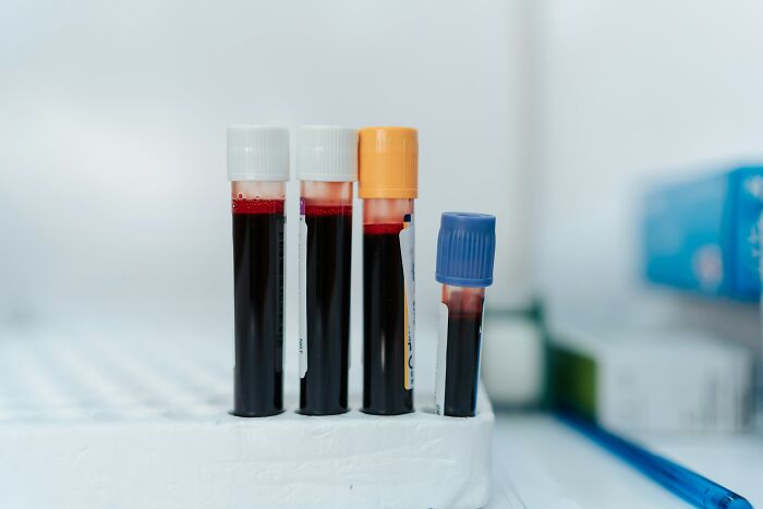 Blood sample tubes in lab setting showing protection from harm in medical testing and universe support theme