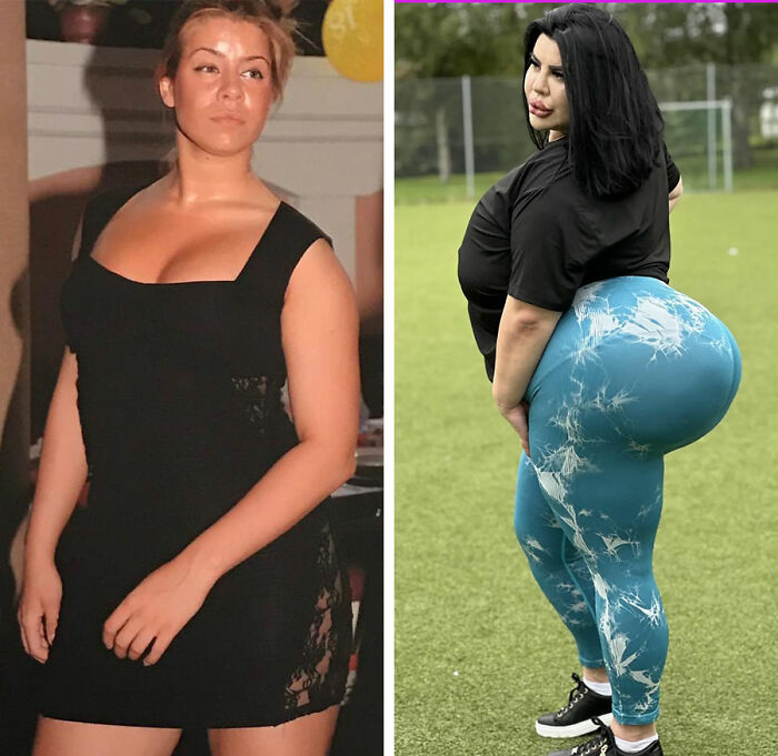 Before and after images of women showcasing results and tragic consequences of BBL surgery for perfect curves.