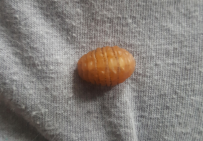 Close-up of unusual object on fabric representing wild patient horror stories dentists still think about