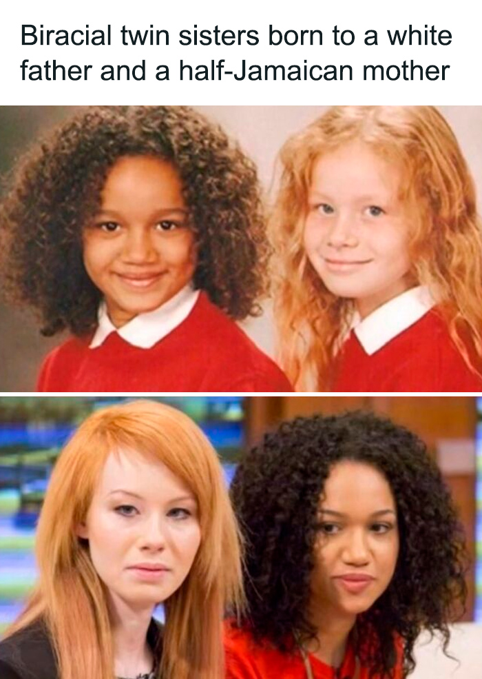 Biracial twin sisters featured on an IG page sharing daily facts and interesting stories with 1.8M followers.