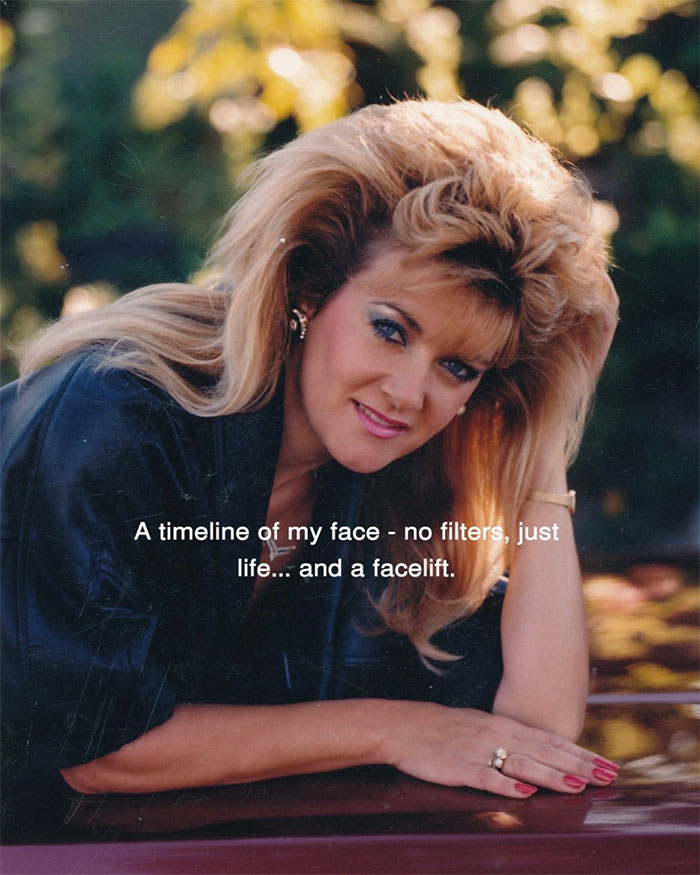 Woman sharing aging progress and how she looks after getting a facelift at 70 years old, smiling outdoors.