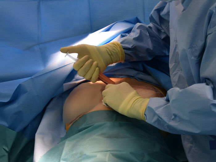 Fake plastic surgeon performing botched silicone injections on patient during a cosmetic procedure in a surgical setting.