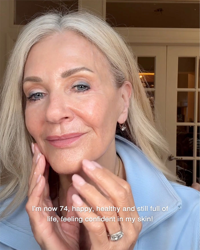 Close-up of a woman showcasing aging progress and facelift results at 70 with healthy, glowing skin and confidence.