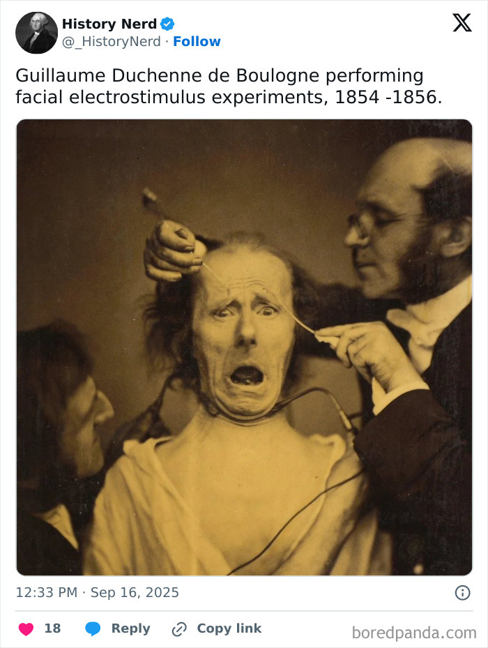 Guillaume Duchenne conducting facial electrostimulus experiments in a rare historic photo from the past.