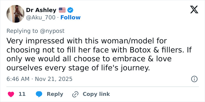 Twitter post praising Paulina Porizkova, 60, for embracing perfect imperfections and natural beauty without fillers. Twitter post praising Paulina Porizkova, 60, for embracing perfect imperfections and natural beauty without fillers.